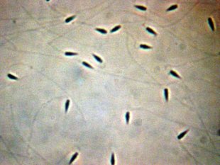 Chapitre 5 | La fécondation | Documents : 3 Spermatozoïdes