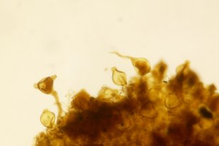 Chapitre 5 | La fécondation | Documents : Germination de spores